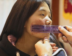 广州肤康皮肤病医院