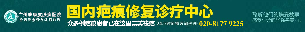 广州肤康皮肤病医院