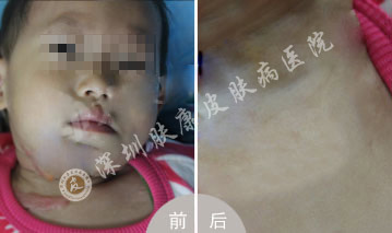 ���ݷ���Ƥ����ҽԺ