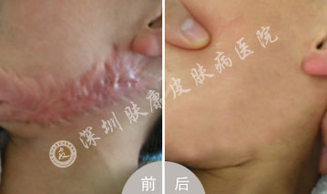 ���ݷ���Ƥ����ҽԺ