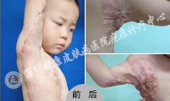 ���ݷ���Ƥ����ҽԺ