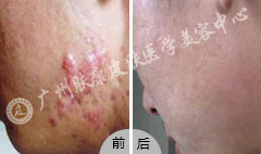 ���ݷ���Ƥ����ҽԺ