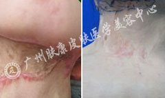 ���ݷ���Ƥ����ҽԺ