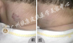 ���ݷ���Ƥ����ҽԺ