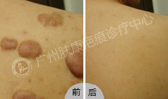 ���ݷ���Ƥ����ҽԺ