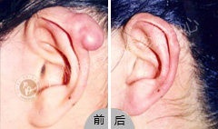 ���ݷ���Ƥ����ҽԺ