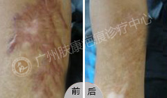 ���ݷ���Ƥ����ҽԺ