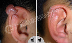 ���ݷ���Ƥ����ҽԺ