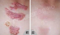 ���ݷ���Ƥ����ҽԺ