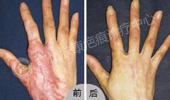 ���ݷ���Ƥ����ҽԺ