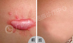 ���ݷ���Ƥ����ҽԺ