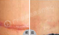 ���ݷ���Ƥ����ҽԺ