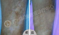 ���ݷ���Ƥ����ҽԺ