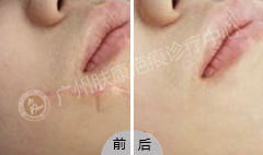 ���ݷ���Ƥ����ҽԺ