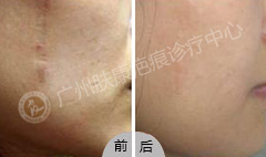 ���ݷ���Ƥ����ҽԺ