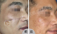 ���ݷ���Ƥ����ҽԺ