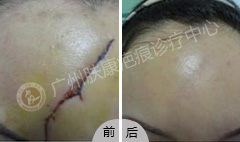 ���ݷ���Ƥ����ҽԺ