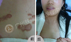 ���ݷ���Ƥ����ҽԺ