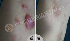 ���ݷ���Ƥ����ҽԺ