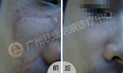 ���ݷ���Ƥ����ҽԺ