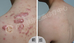 ���ݷ���Ƥ����ҽԺ