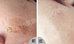 ���ݷ���Ƥ����ҽԺ