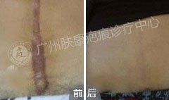 ���ݷ���Ƥ����ҽԺ