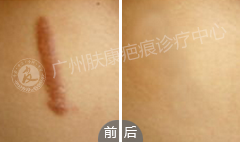 ���ݷ���Ƥ����ҽԺ