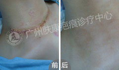 ���ݷ���Ƥ����ҽԺ