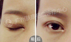 ���ݷ���Ƥ����ҽԺ