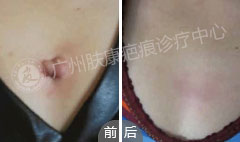 ���ݷ���Ƥ����ҽԺ