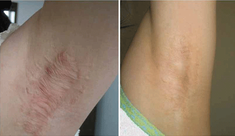 ���ݷ���Ƥ����ҽԺ