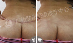 ���ݷ���Ƥ����ҽԺ