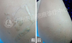 ���ݷ���Ƥ����ҽԺ