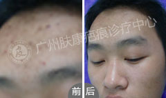 ���ݷ���Ƥ����ҽԺ