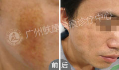 ���ݷ���Ƥ����ҽԺ