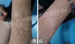 ���ݷ���Ƥ����ҽԺ