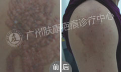 ���ݷ���Ƥ����ҽԺ