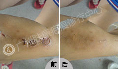 ���ݷ���Ƥ����ҽԺ