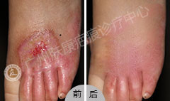 ���ݷ���Ƥ����ҽԺ