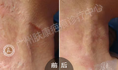 ���ݷ���Ƥ����ҽԺ