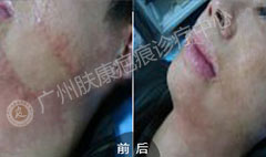 ���ݷ���Ƥ����ҽԺ