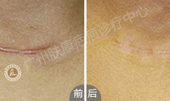 ���ݷ���Ƥ����ҽԺ