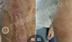 ���ݷ���Ƥ����ҽԺ