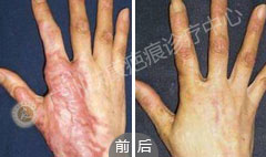 ���ݷ���Ƥ����ҽԺ