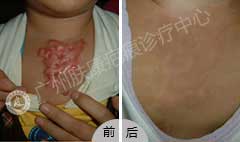 ���ݷ���Ƥ����ҽԺ