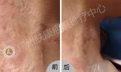 ���ݷ���Ƥ����ҽԺ