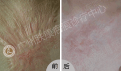 ���ݷ���Ƥ����ҽԺ