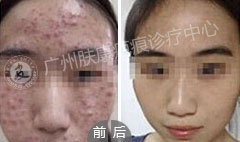 ���ݷ���Ƥ����ҽԺ