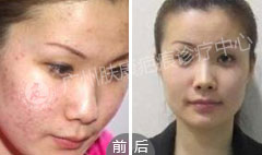 ���ݷ���Ƥ����ҽԺ